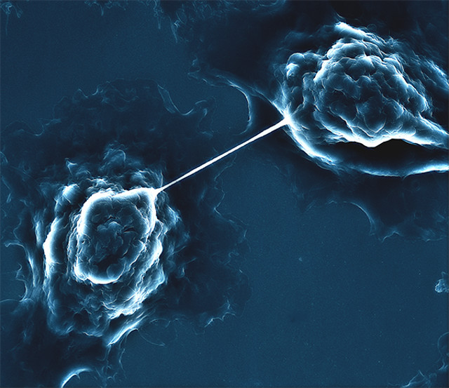 Hai tế bào ung thư tuyến tụy tạo thành một ống nano đường hầm, một phần mở rộng của màng tế bào cho phép họ để trao đổi tài liệu và thông tin, trong ảnh chụp hiển vi điện tử quét này.