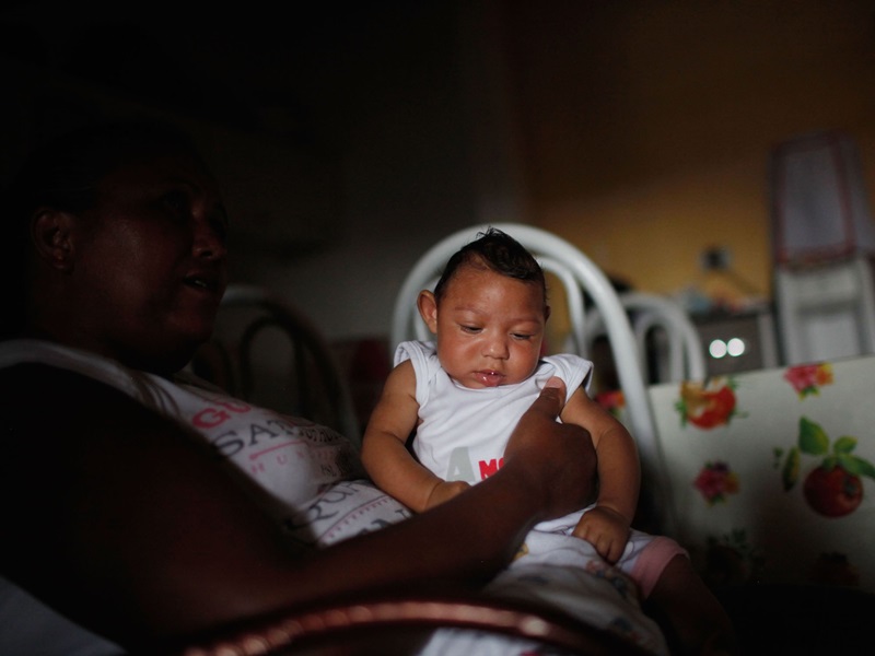 Alice Vitoria Gomes Bezerra, 3 tháng tuổi, một trường hợp mắc tật đầu nhỏ tại Recife, Brazil.