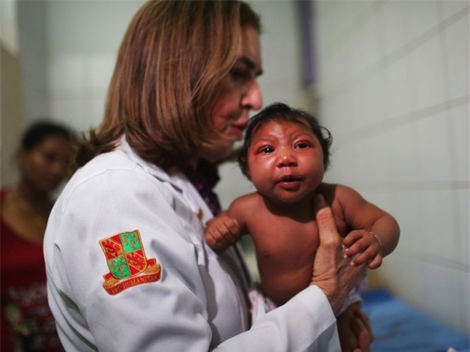Một nhóm bác sĩ Argentina cho rằng dịch teo não bất thường ở trẻ sơ sinh tại Brazil không phải do virút Zika mà do một loại hóa chất diệt ấu trùng có trong nguồn nước sinh hoạt - Ảnh: Techtimes