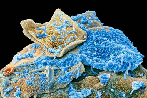Kính hiển vi điện tử đã quét được những ngóc ngách trong miệng con người, chụp ảnh vi khuẩn. Bằng việc phóng to gấp 10.000 lần và nhuộm màu để nhấn mạnh hình ảnh, có thể nhìn rõ những loại vi khuẩn sống ở mặt trong của má, nướu và răng.