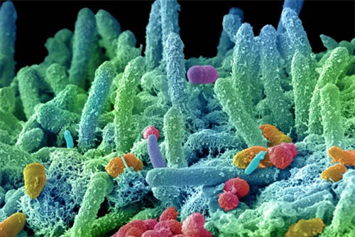 Những hình ảnh này trông giống như xúc tu của loài hải quỳ ở một rạn san hô dưới đáy biển. Nhưng sự thực, những sinh vật nhiều màu sắc này là vi khuẩn sống trong miệng người.
