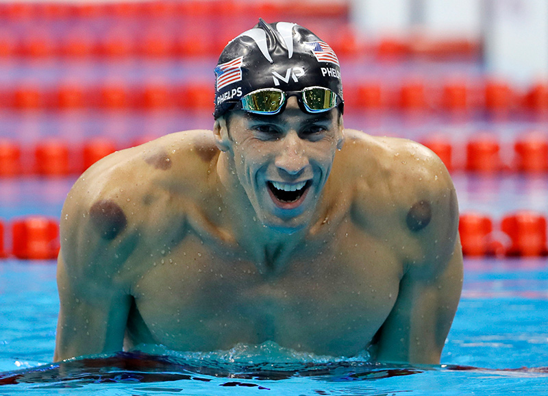 Kình ngư Michael Phelps - một “tín đồ” của liệu pháp giác hơi. Ảnh: Wane