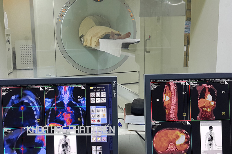 Các bác sỹ Trung tâm Y học hạt nhân và ung bướu (Bệnh viện Bạch Mai) đang tiến hành chụp PET/CT cho bệnh nhân ung thư phổi. Ảnh: PN