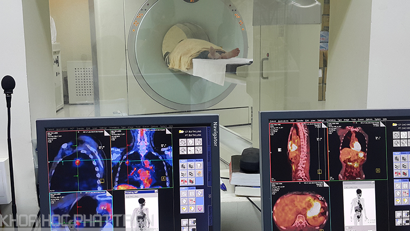 Bệnh nhân ung thư phổi đang được chụp bằng kỹ thuật PET/CT tại Trung tâm Y học hạt nhân và Ung bướu. Ảnh HM.