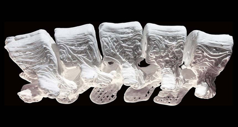 Khung xương được in bằng công nghệ 3D có tính mềm dẻo cao được sử dụng để chữa những xương bị gãy hoặc bị hư hỏng.