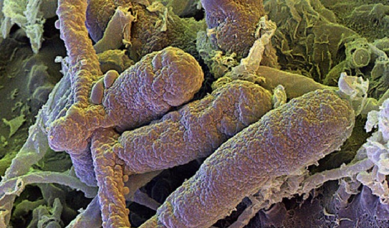 1. Bệnh nấm da (hắc lào) do một nhóm nấm có tên dermatophytes gây nên. Hay gặp nhất là ba loại microsporum, trychophyton và epidermophyton. Ảnh minh họa.