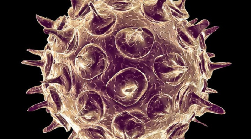 1.	Zona không phải là một bệnh nhiễm trùng, mà nó là sự tái phát của virus gây bệnh thủy đậu (Virus Varicella).Đối với người đã từng mắc bệnh thủy đậu, sau khi khỏi, virut vẫn chưa bị tiêu diệt hoàn toàn mà ẩn trong các tế bào thần kinh dưới dạng không hoạt động. Ảnh minh họa.