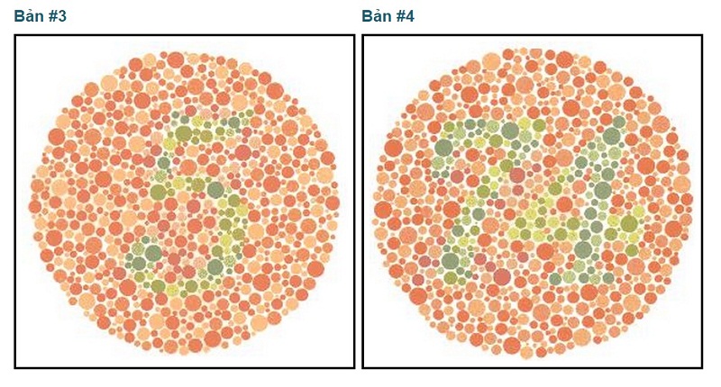 Một bài kiểm tra bệnh mù màu. Nếu bạn nhìn thấy số 5 và số 24 thì bạn không bị mù màu.