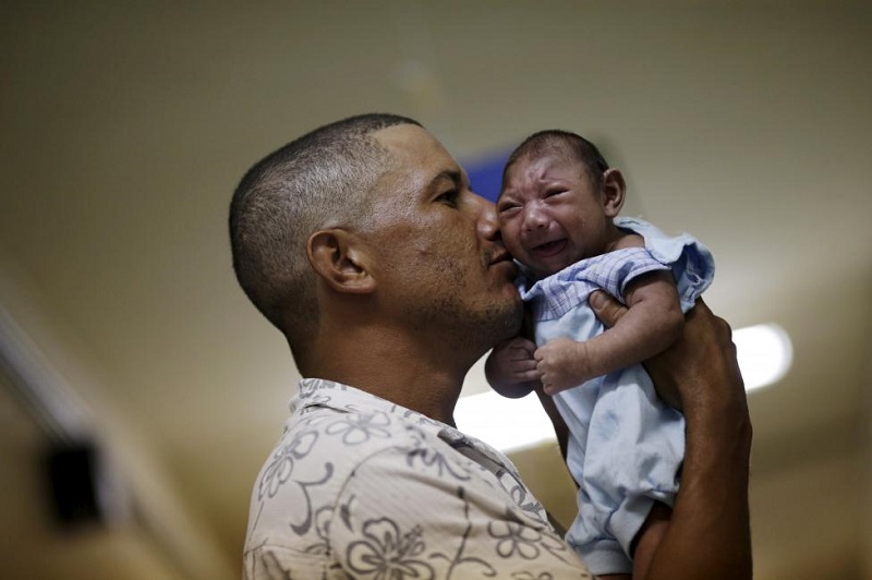 Một đứa bé bị teo não do virus Zika.