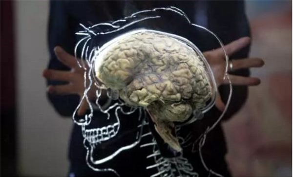 Nhà khoa học tuyên bố giúp người chết não sống lại - 2