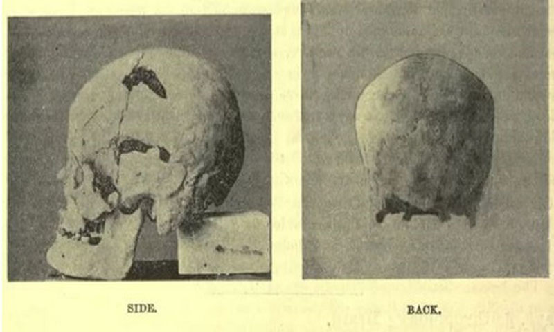 Hộp sọ thuộc hài cốt pharaoh Sa-Nakht. Ảnh: Wikipedia.