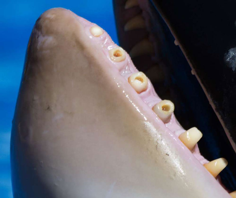 Hàm răng của cá voi sát thủ bị hư hại.