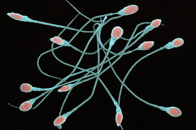 Thiết bị tính “tuổi” tinh trùng giúp nam giới nhận thức được tình trạng sức khỏe sinh sản của mình. Ảnh: Getty Images/Scien Photo Library RM.
