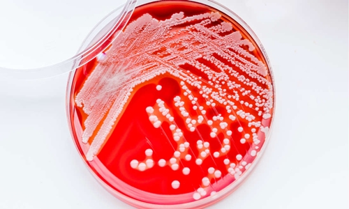 Loại kháng sinh mới được tạo ra từ những phân tử có trong một số loại đất. Ảnh: Shutterstock.