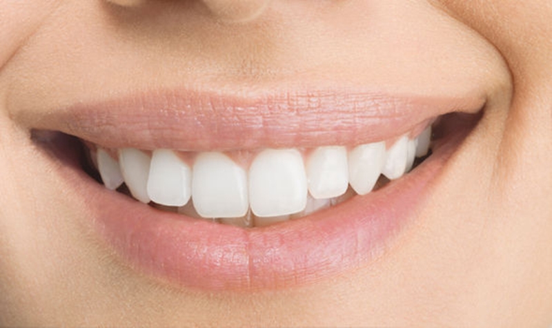 Răng là bộ phận duy nhất trên cơ thể người không thể tự sửa chữa. Ảnh: Express.