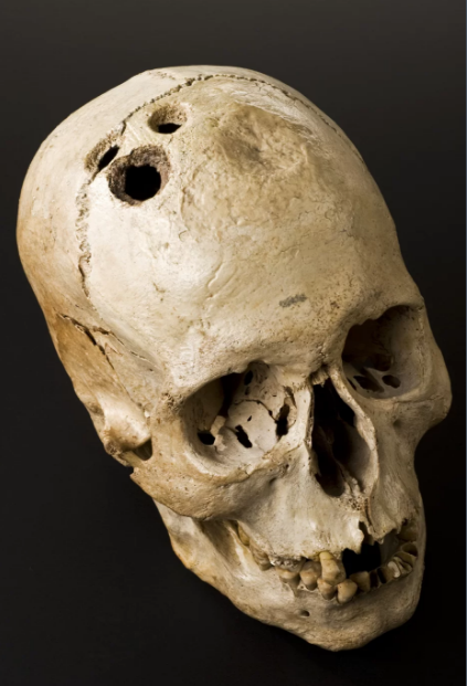 Một hộp sọ phát hiện trong lăng mộ ở Israel. Ảnh: Science Museum, London/Wellcome Images