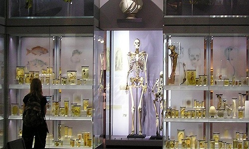 Bộ xương của Charles Byrne trưng bày trong bảo tàng Hunterian. Ảnh: Science Alert.
