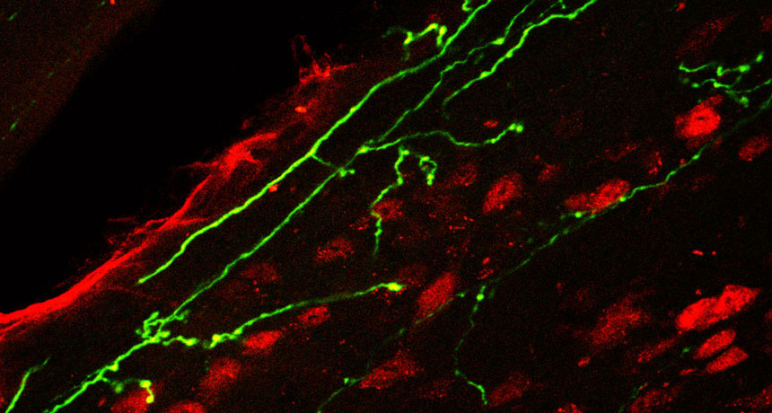 Thuốc giảm đau từ botulinum toxin ngăn không cho một số tế bào thần kinh (màu xanh) nhất định tiếp nhận thông tin về cơn đau lên não bộ chuột.