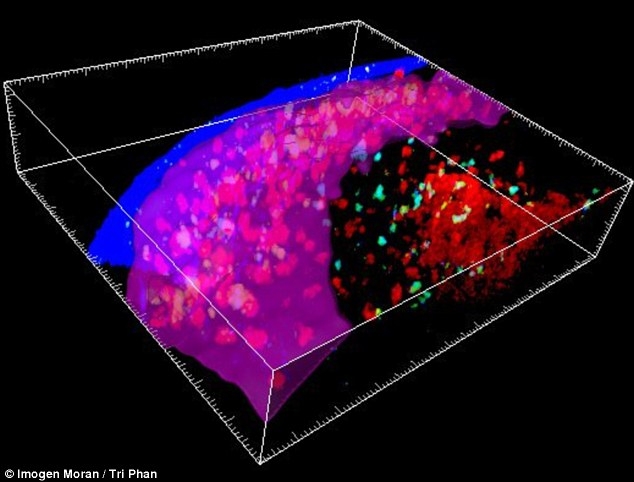 Cấu trúc nhỏ trong hệ miễn dịch (màu hồng và tím) chứa một lượng lớn các tế bào miễn dịch xuất hiện gần hạch bạch huyết khi một người bắt đầu chống lại nhiễm trùng - Ảnh: Imogen Mogan