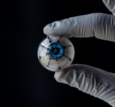 Các nhà nghiên cứu thuộc ĐH Minesota đã in 3D tia cảm thụ hình ảnh trên một khung bán cầu, tạo ra nguyên mẫu “con mắt điện tử” đầu tiên. Ảnh: Nhóm nghiên cứu McAlpine, Đại học Minnesota 