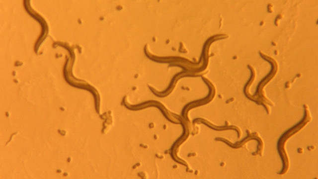 Những con giun tên C. elegans có nhiều đặc điểm sinh học giống người - Ảnh: Internet