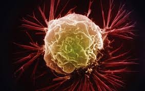 Tăng mật độ mô vú có thể là dấu hiệu ung thư vú - Ảnh : Getty Images