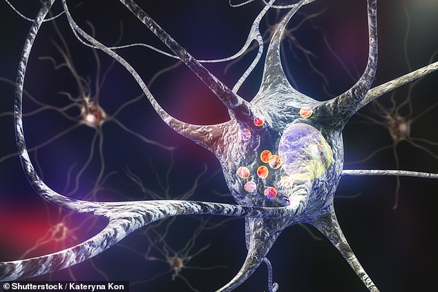 Loại bỏ phân tử USP13 giúp não làm sạch các thể lewy - lớp lắng đọng protein độc hại tích tụ bên trong các tế bào thần kinh (được minh họa bằng các vòng tròn màu đỏ trong ảnh) là nguyên nhân dẫn đến bệnh Parkinson - Ảnh : Shutterstock