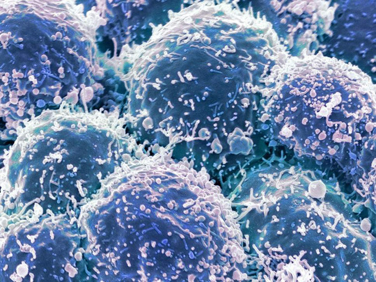 Các tế bào ung thư - ảnh: INDEPENDENT