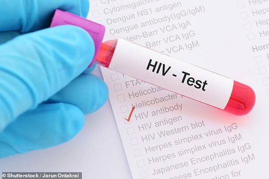 Gene mới phát hiện đưa đến hy vọng tạo ra một phác đồ chữa khỏi hoàn toàn HIV -ảnh: SHUTTERSTOCK