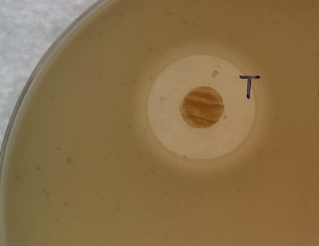 Vi khuẩn Streptomyces sp. Myrophorea trong ảnh là chấm mầu nâu sẫm, còn vầng sáng bao quanh là tụ cầu vàng kháng methicillin (MRSA) bị ngăn chặn - Ảnh: Đại học Swansea