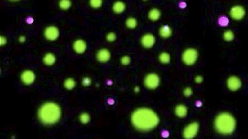 Các giọt chất lỏng hình thành từ protein trong tế bào. Ảnh: Science