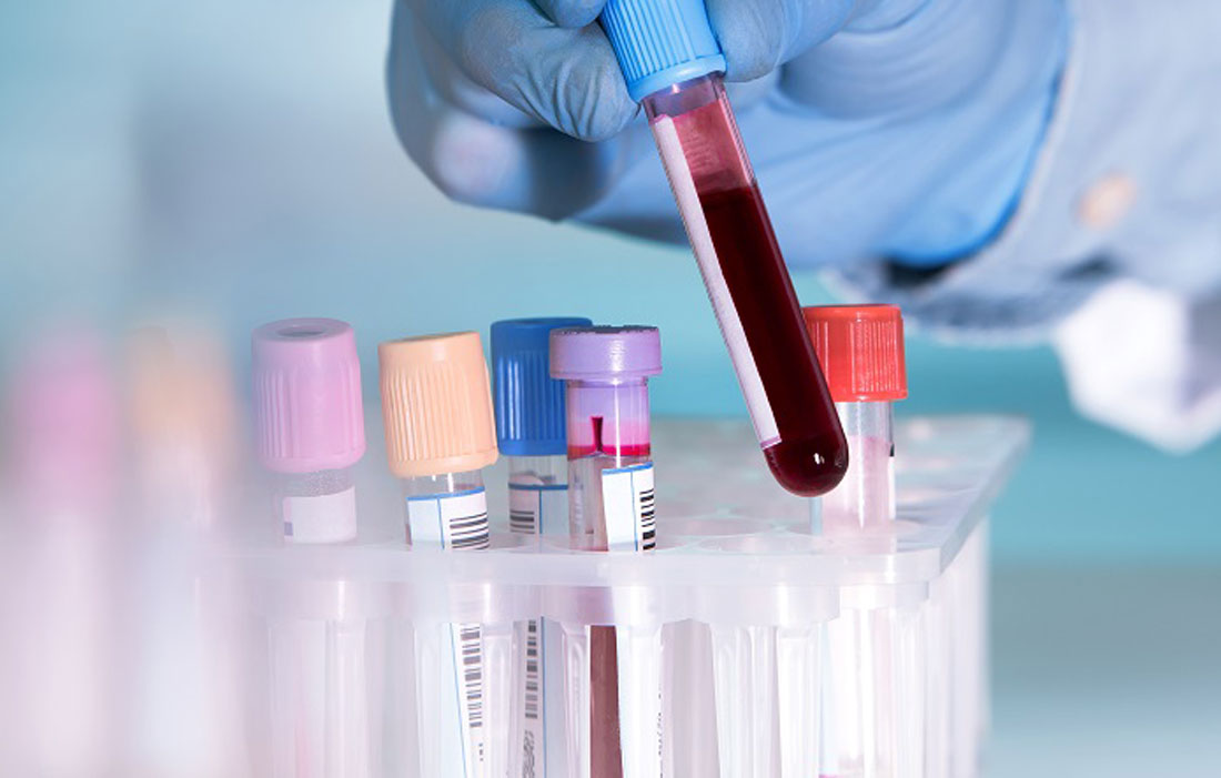 Lấy mẫu máu để phục vụ cho xét nghiệm
