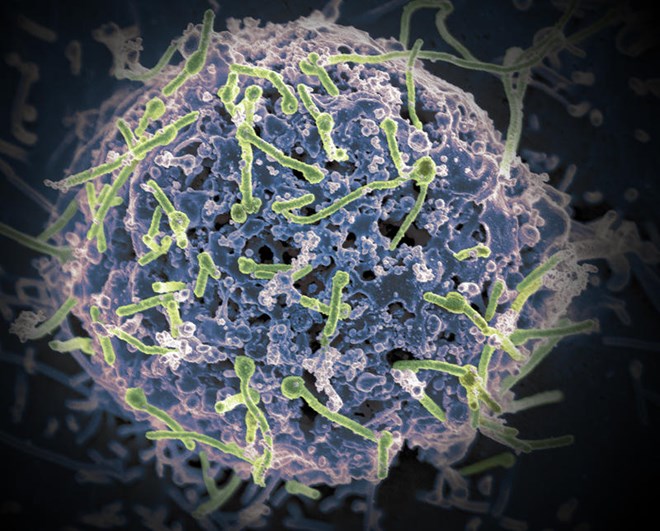 Virus Ebola. (Nguồn: wvxu.org)