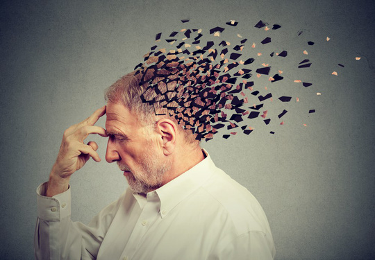 Alzheimer hiện chưa có thuốc chữa - ảnh minh họa từ internet