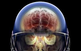 Càng nhiều chấn thương đầu dù nhẹ như ở các VĐV bóng bầu dục Mỹ thì các lớp lắng đọng protein tau trong não càng nhiều - Ảnh : Getty Images