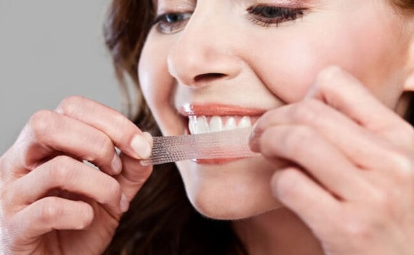 Miếng dán làm trắng răng có thành phần chủ yếu là hydrogen peroxide (H2O2). Ảnh: AFP