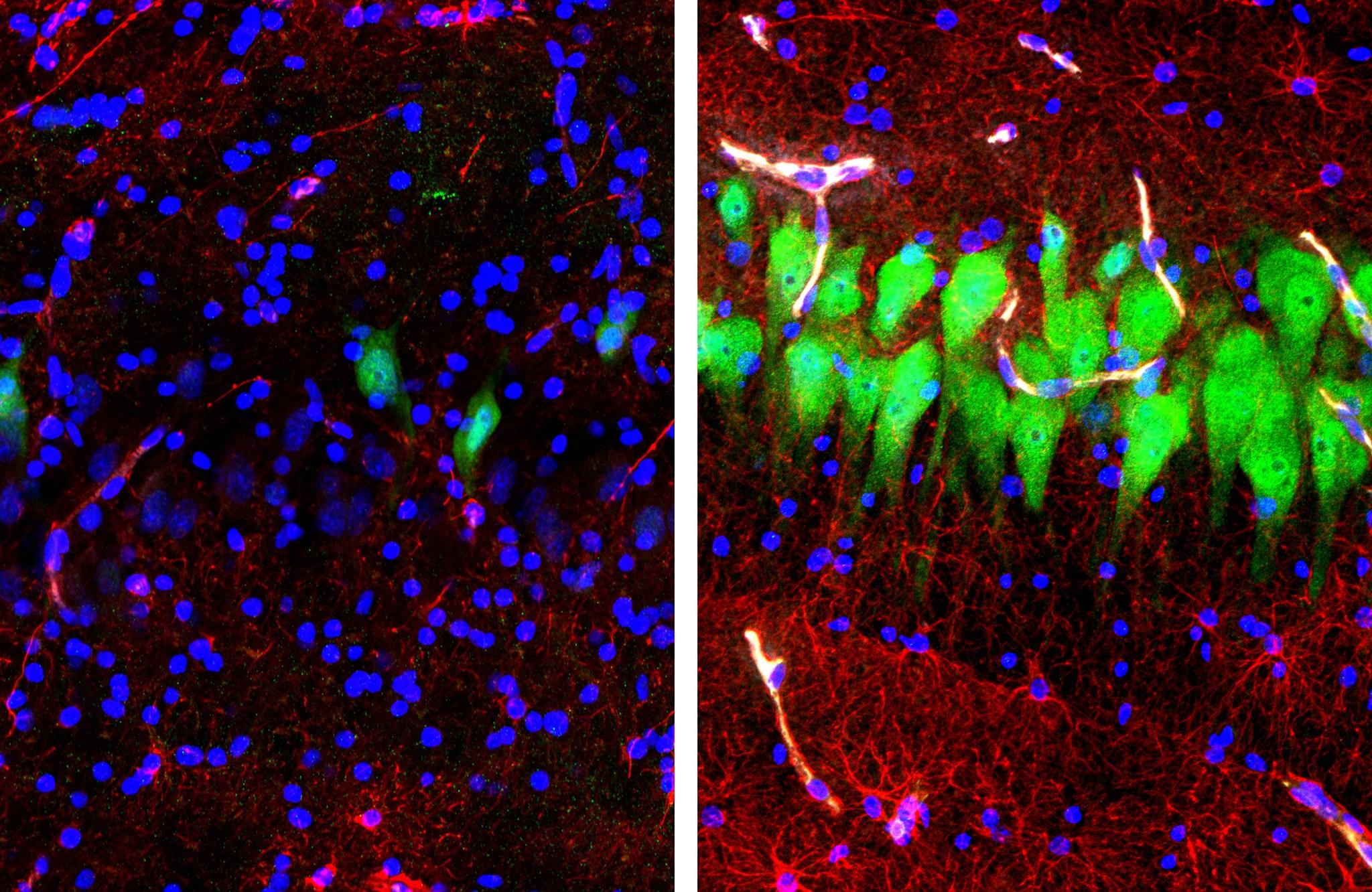 Nơ ron (xanh), tế bào hình sao (đỏ), nhân tế bào (xanh lục) trong bộ não của lợn. Hình trái là tế bào não để không 10 tiếng sau khi chết, hình bên phải là tế bào não trong thí nghiệm. Ảnh: Stefano G. Daniele và Zvonimir Vrselja, Đại học Y khoa Yale. 