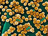 Sự hiện diện của vi khuẩn Staphylococcus aureus (S.aureus) làm tăng nguy cơ phát triển dị ứng với lạc, trứng và sữa bò - Ảnh: Wikipedia.org