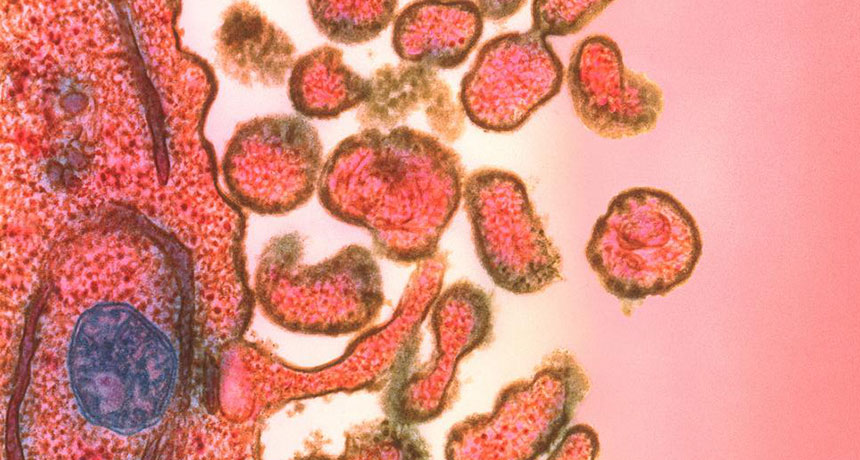 Xóa trí nhớ miễn dịch: Virus sởi chui ra từ một tế bào nhiễm bệnh (bên trái) sau khi nhân bản bên trong tế bào.