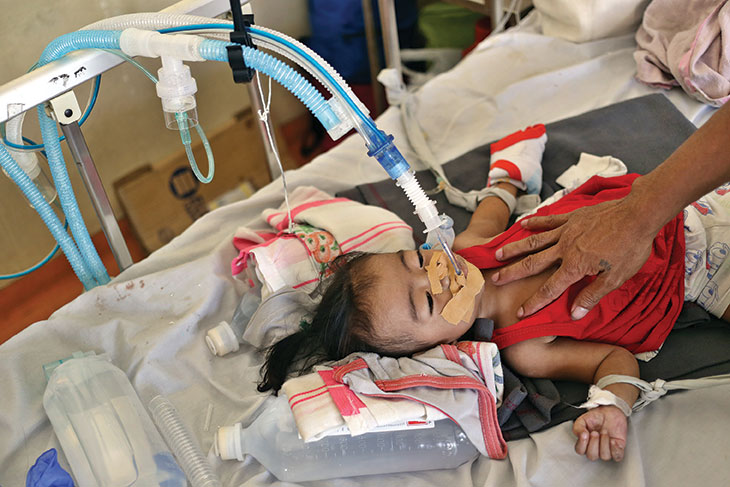 Đứa trẻ người Philippin này được điều trị nhiễm sởi vào tháng Hai. Căn bệnh có thể gây ra các vấn đề về hô hấp.