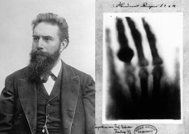 Chân dung nhà vật lý Rontgen và bức ảnh X-quang chụp bàn tay vợ của ông. Ảnh: Wikimedia.