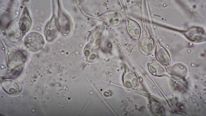 Henneguya salminicola nhìn dưới kính hiển vi. Ảnh: Live Science.