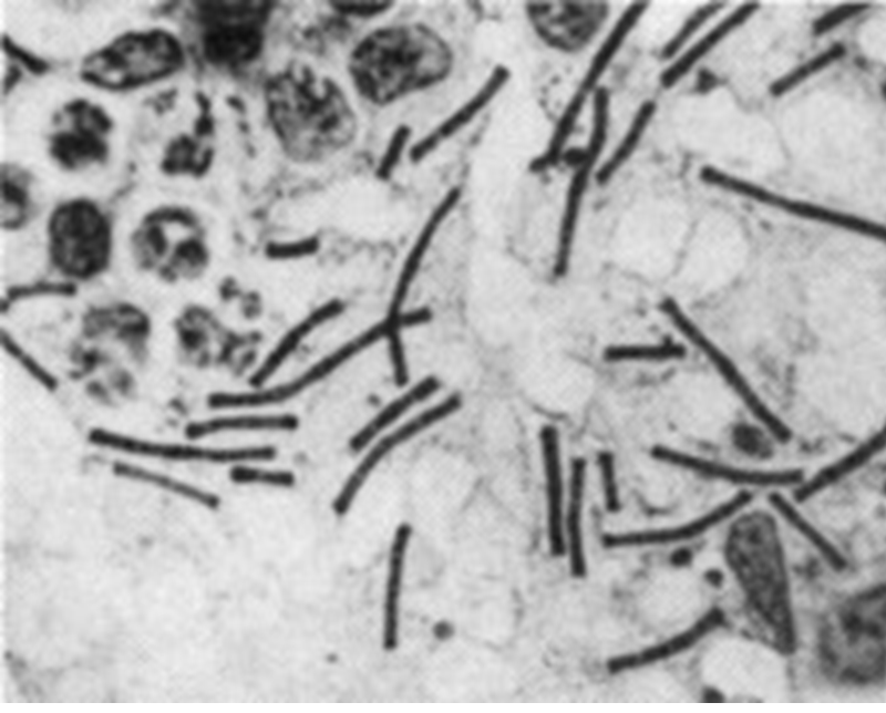 Những bức ảnh chụp trực khuẩn than lần đầu tiên trên thế giới do Koch nghiên cứu.