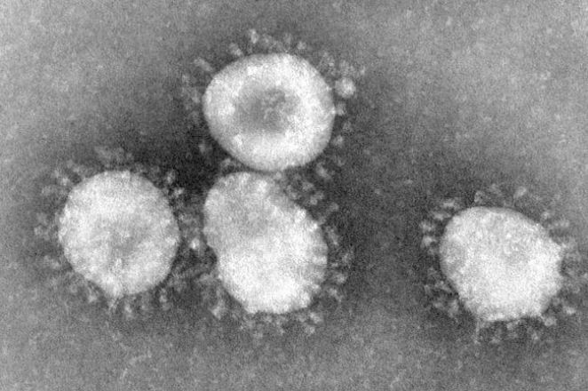 Bốn virus corona khi nhìn qua kính hiển vi điện tử. Những “gai” bao xung quanh tạo thành hình dạng như một chiếc vương miện. Ảnh: BSIP.