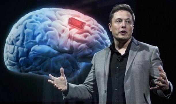 Elon Musk. Ảnh: Neuralink.