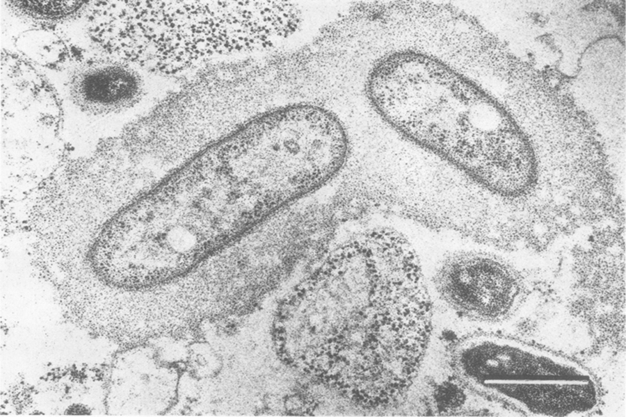 Vi khuẩn Rickettsia prowazekii gây bệnh sốt phát ban. Ảnh: Researchgate.