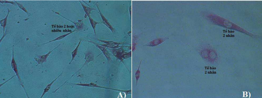 Tế bào gốc trung mô chuột sau khi biệt hóa thành tế bào chức năng gan và nhuộm với PAS (độ phóng đại 100x). Ảnh: NVCC