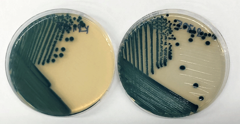 Màu sắc khuẩn lạc (xanh đen, bên phải) của Kleb.pneumoniae kháng carbapenem trên đĩa ChromAgar CRE sản xuất tại Việt Nam