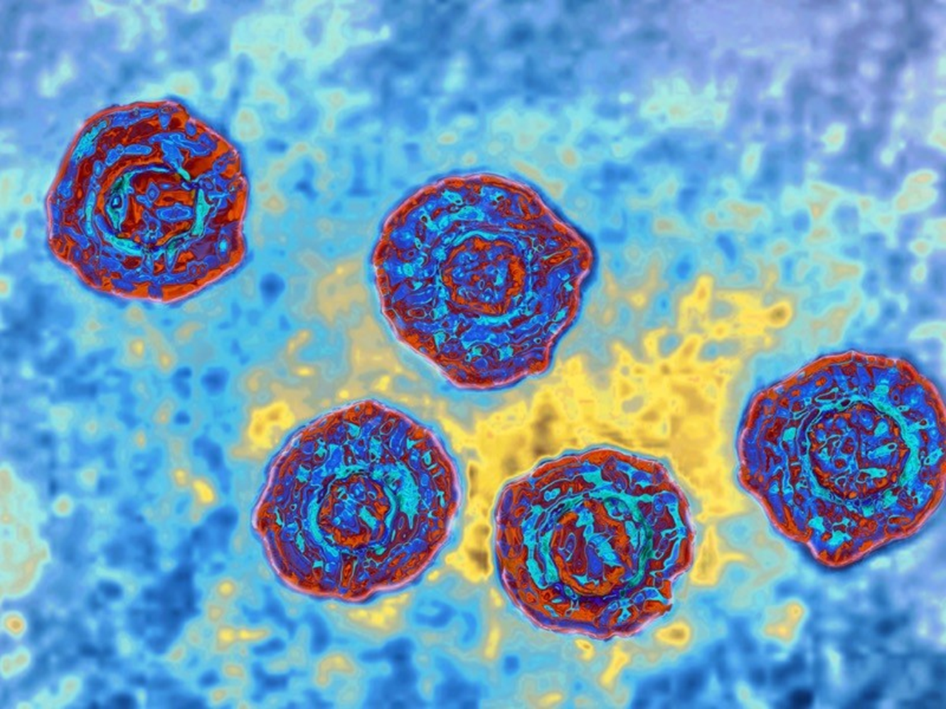 Hình ảnh của virus viêm gan C qua kính hiển vi điện tử quét truyền qua. Ảnh: Cavallini James/BSIP/SPL