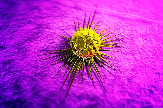 Tế bào đột biến bắt đầu phân chia vô tội vạ. Điều này có thể dẫn đến khối u ung thư.